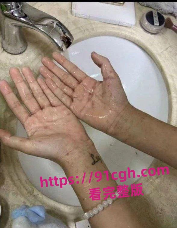 溧阳开放大学生化母体李思妤 生日约男同学玩群P 结果全部感染梅毒！-5